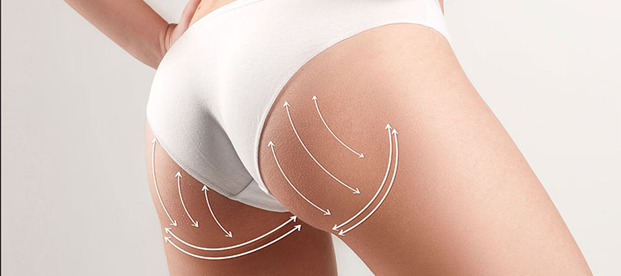 Guaina colombiana solleva glutei per valorizzare la tua figura
